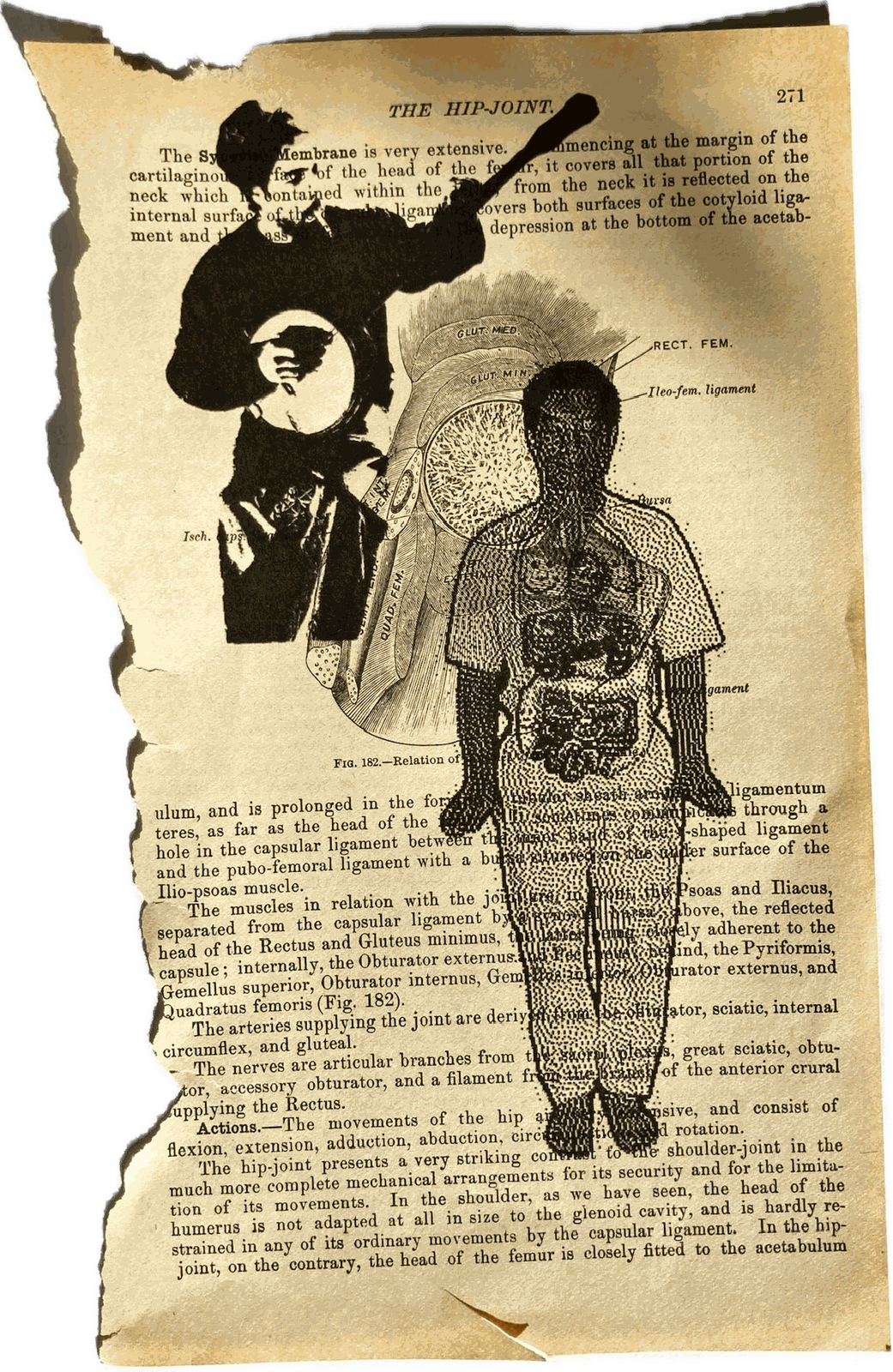 A torn page from an old anatomy textbook, THE HIP-JOINT, page 271, carrying an engraving of the hip muscles. Two photographs are printed over it in flat black: at the top left a figure in a wide-brimmed hat playing a banjo, and down the right a standing figure in a t-shirt and trousers rendered as dense stipple, so the engraving and the text show through both.