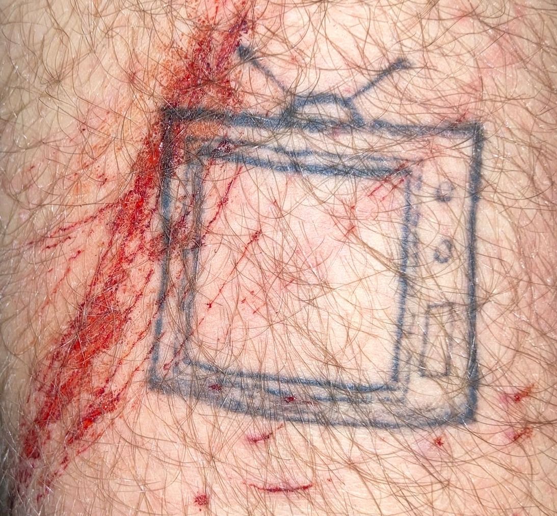 The television tattoo with a fresh scrape of blood smeared across its left edge and up through the antenna, small red specks scattered over the screen.